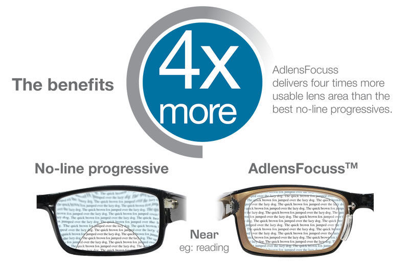 AdLens Features